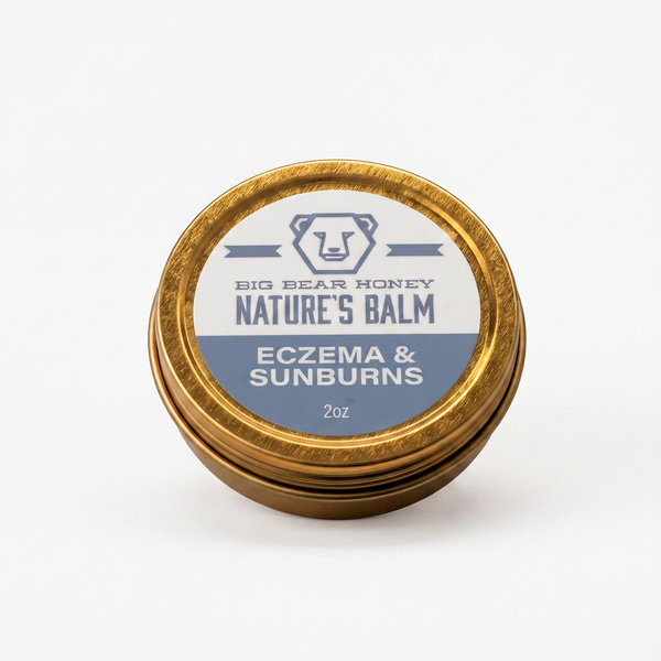Eczema & Burns Balm